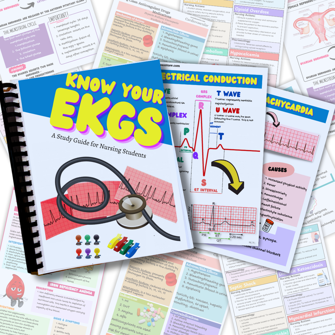 EKG Study Guide (Digital-PDF)