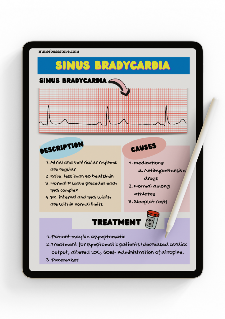 EKG Study Guide (Digital PDF) nursebossstore